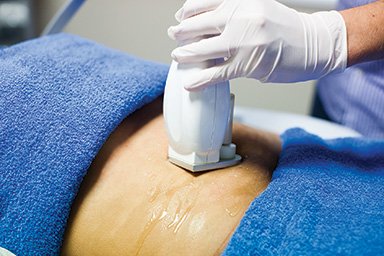 3D Lipo