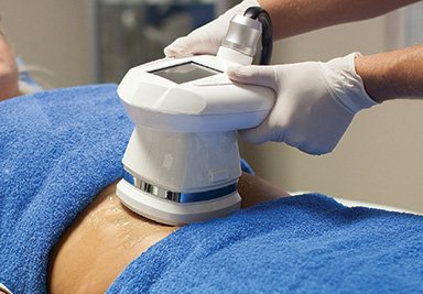 3D Lipo