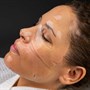 Bio-Therapeutic Hyaluronic Masque Assortment 4pkAlternative Image7