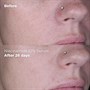 Skin Republic Niacinamide 10% + Zinc 1% Serum 30mlAlternative Image5