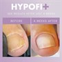 The GelBottle Inc Hypofix Repair Serum 20mlAlternative Image1