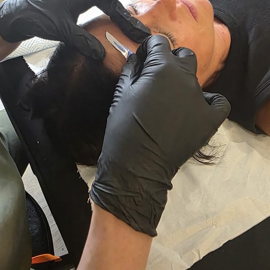 Dermaplaning Course